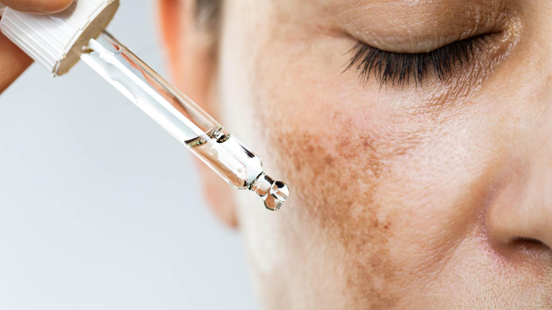 dermatology