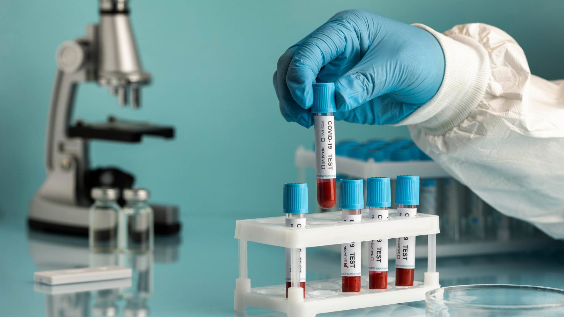 lab-tests