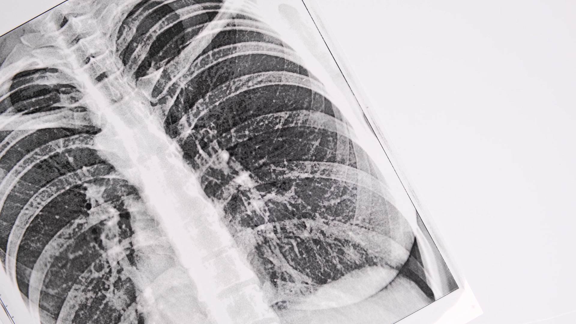 pulmonology