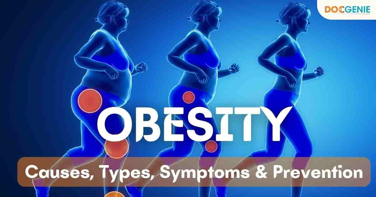 Obesity