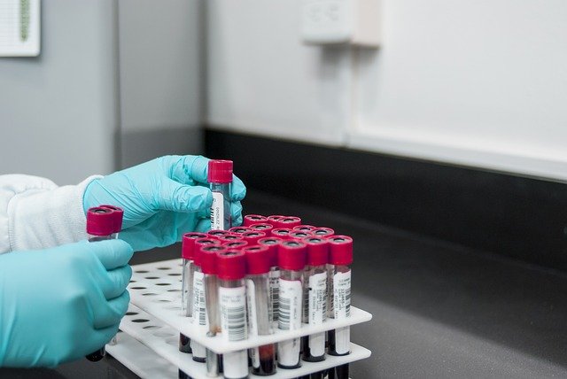 Blood Tests Results: A guide to everything you need to know