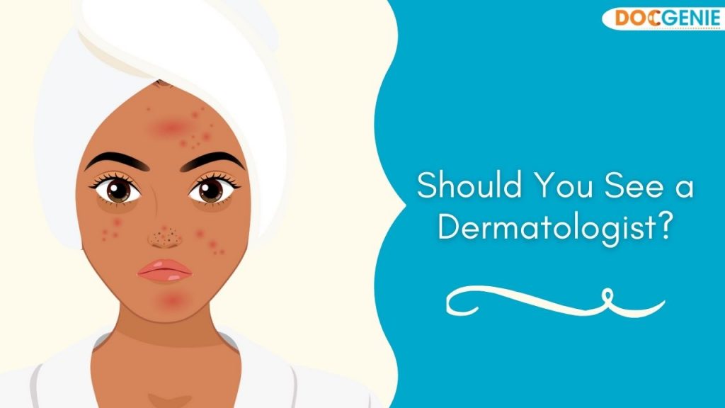 Should you see a dermatologist?